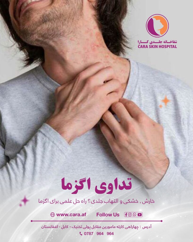 امراض جلدی
